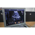 Upgraded Version Laptop Color Doppler Ultrasound Machine